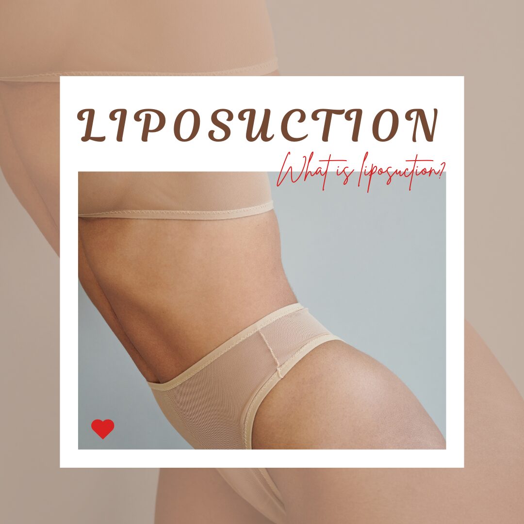 liposuction1