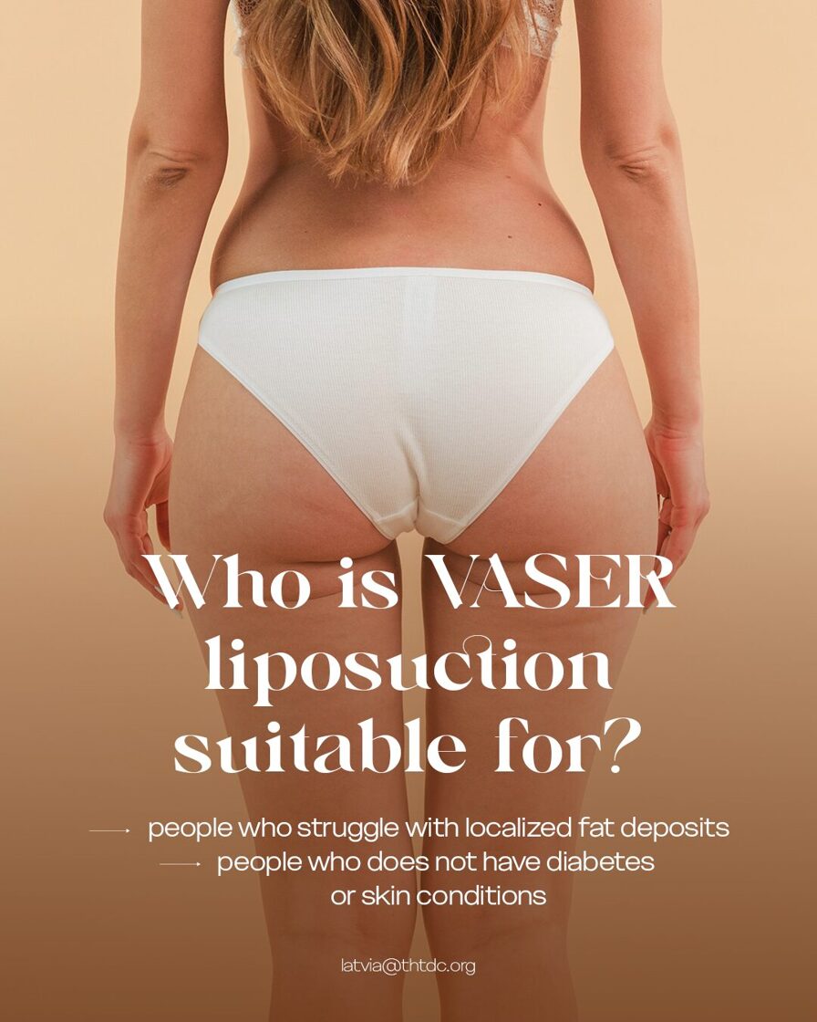 vaser liposuction patients