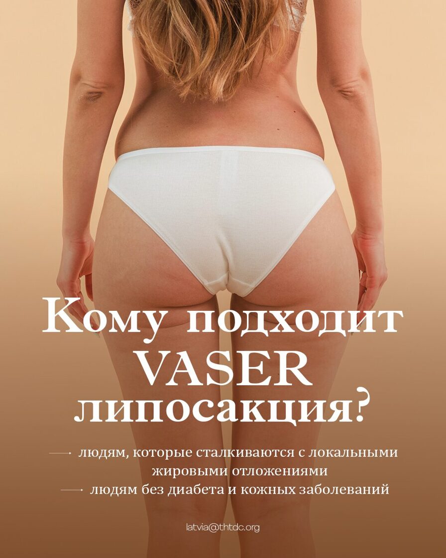 пациенты vaser липосакции
