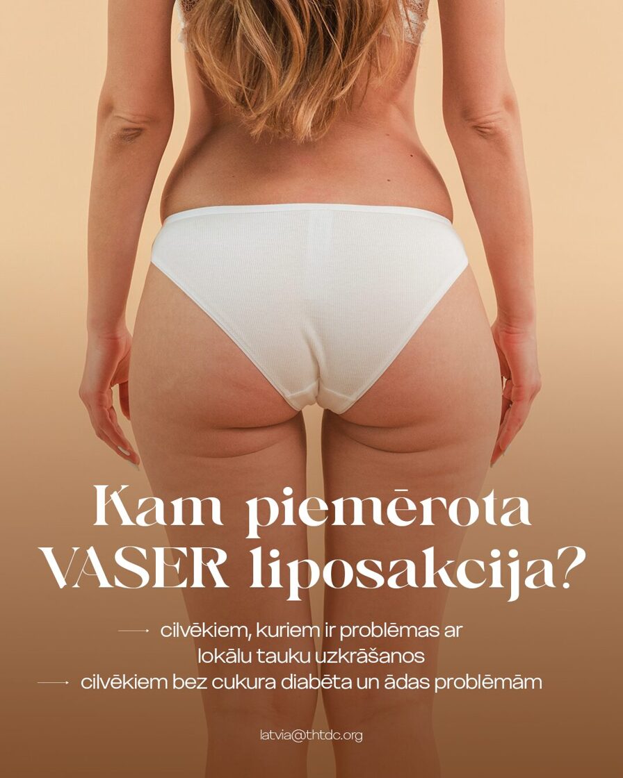 vaser liposakcijas piemērošana