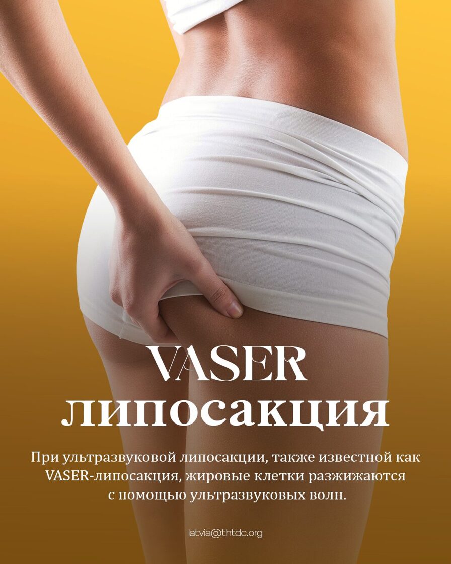 vaser липосакция