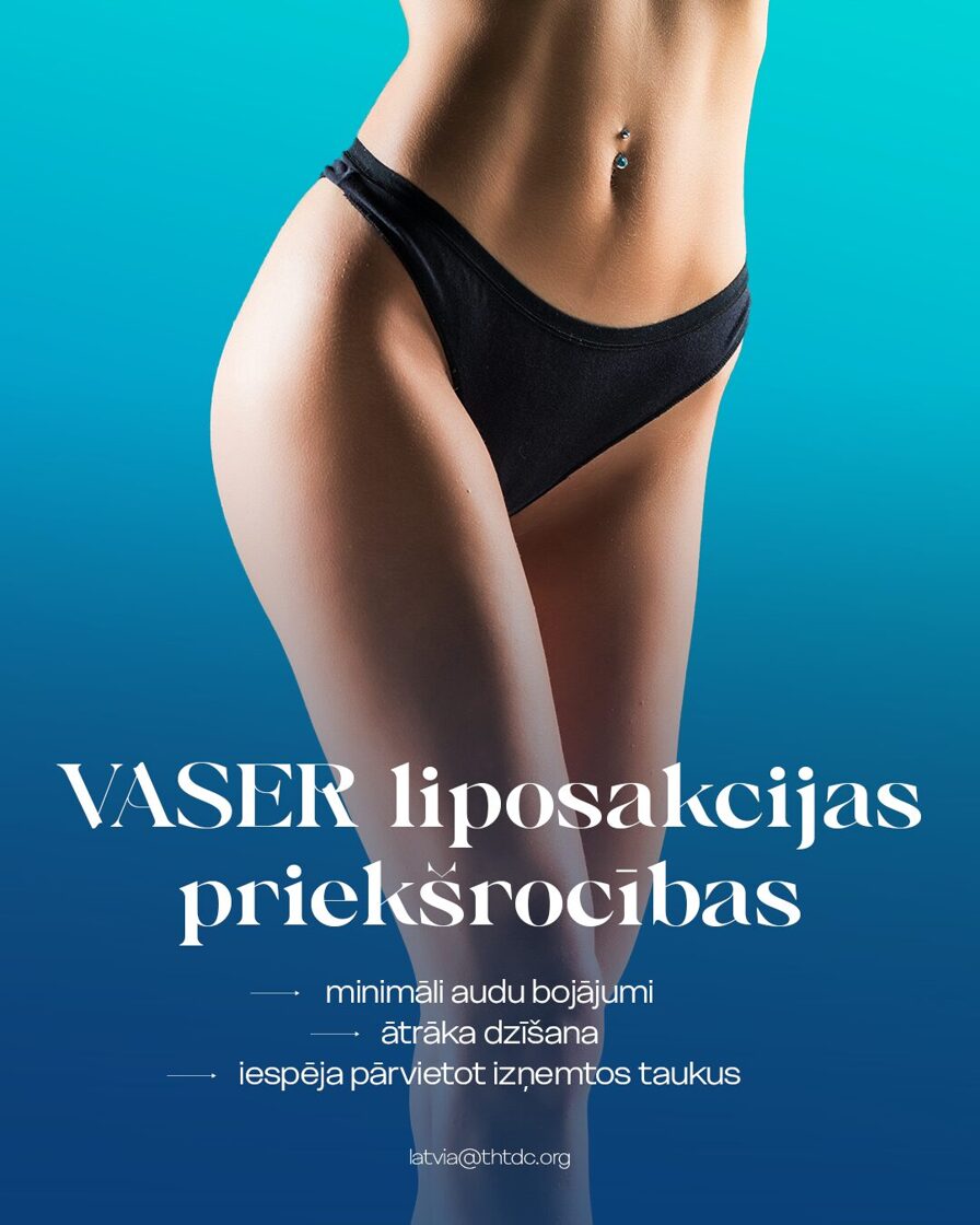 vaser liposakcijas priekšrocības