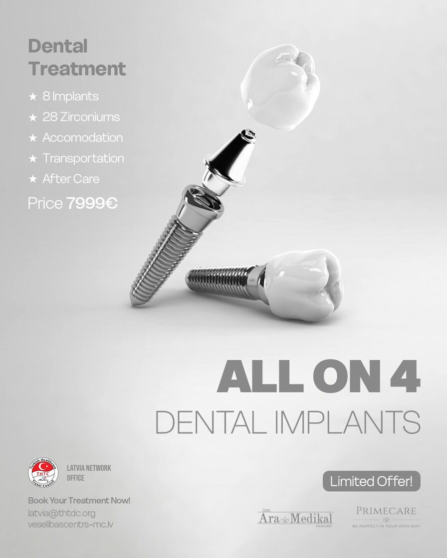 dental implant offer