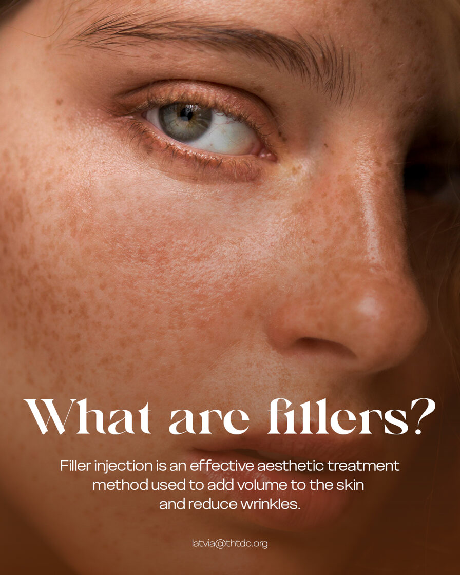 What are fillers?
