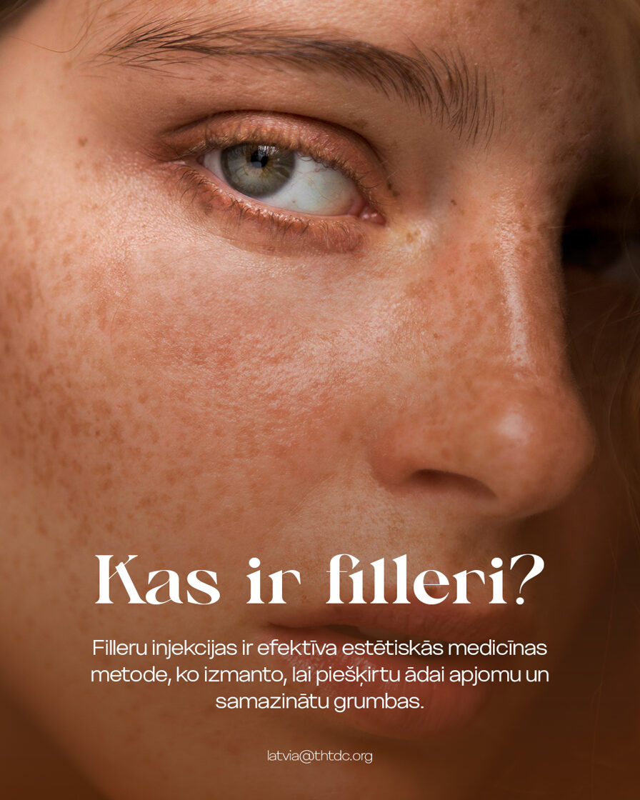 Kas ir filleri?