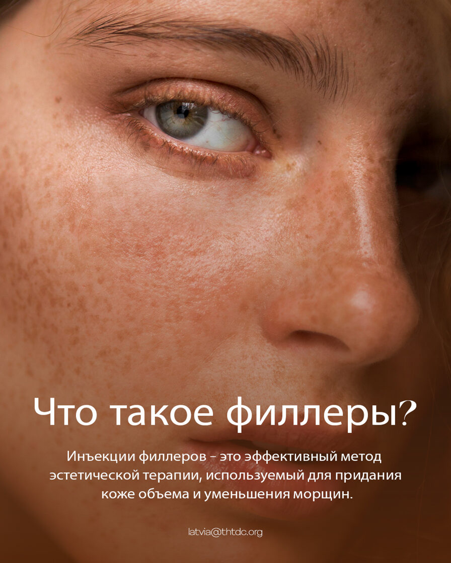 Что такое филлеры?