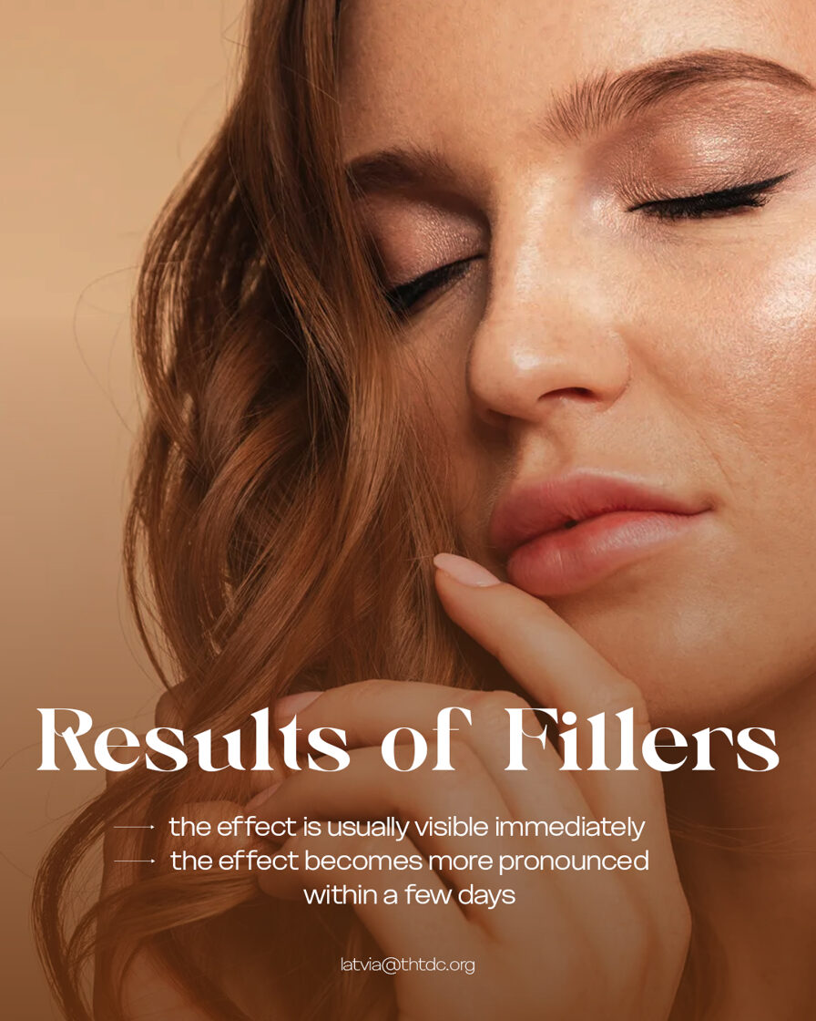results of fillers