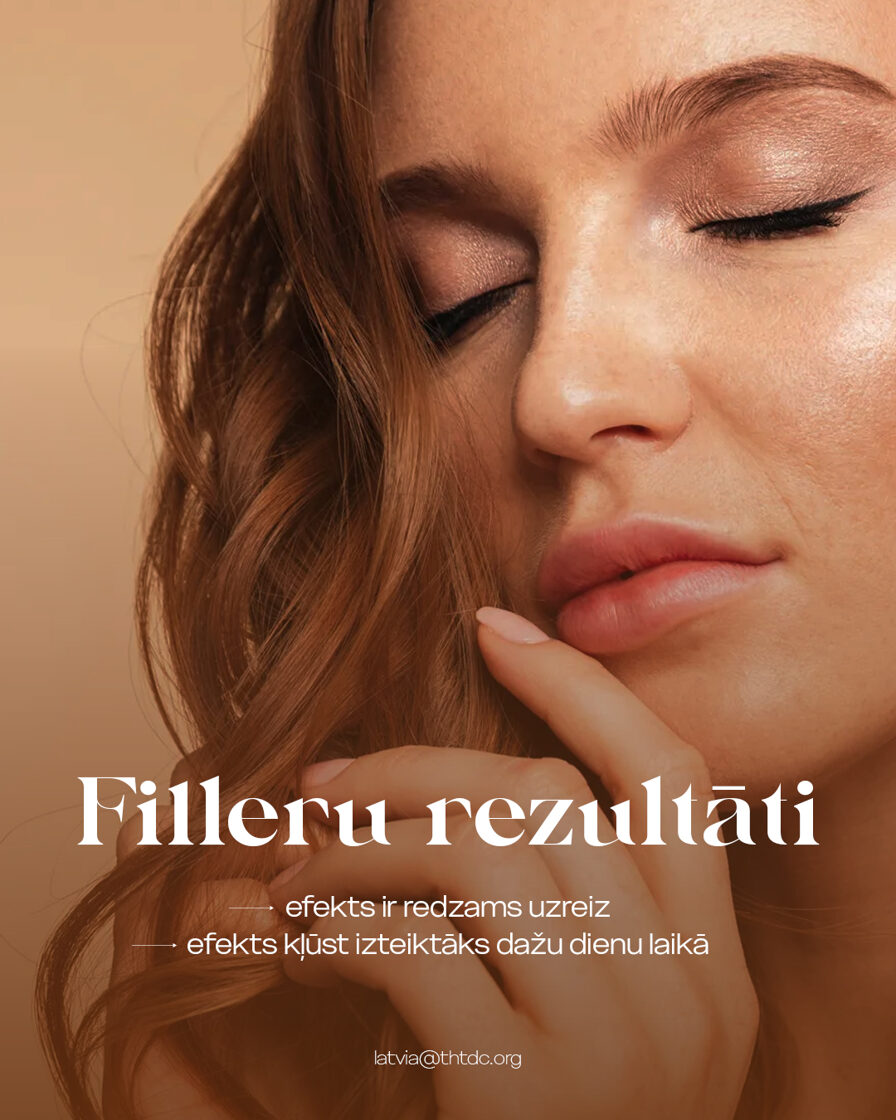 filleru rezultāti
