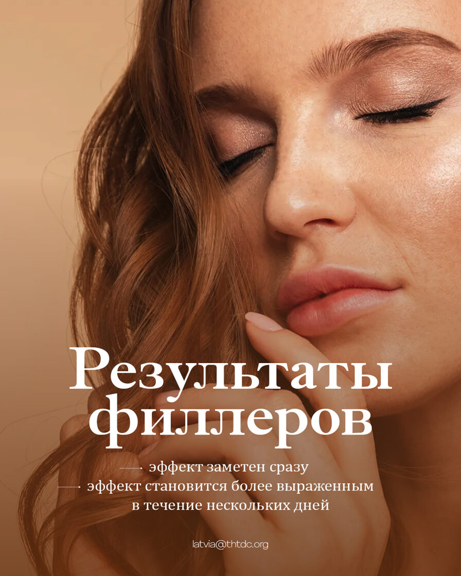 результаты филлеров