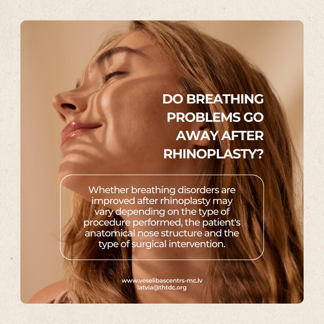 rhinoplasty_6